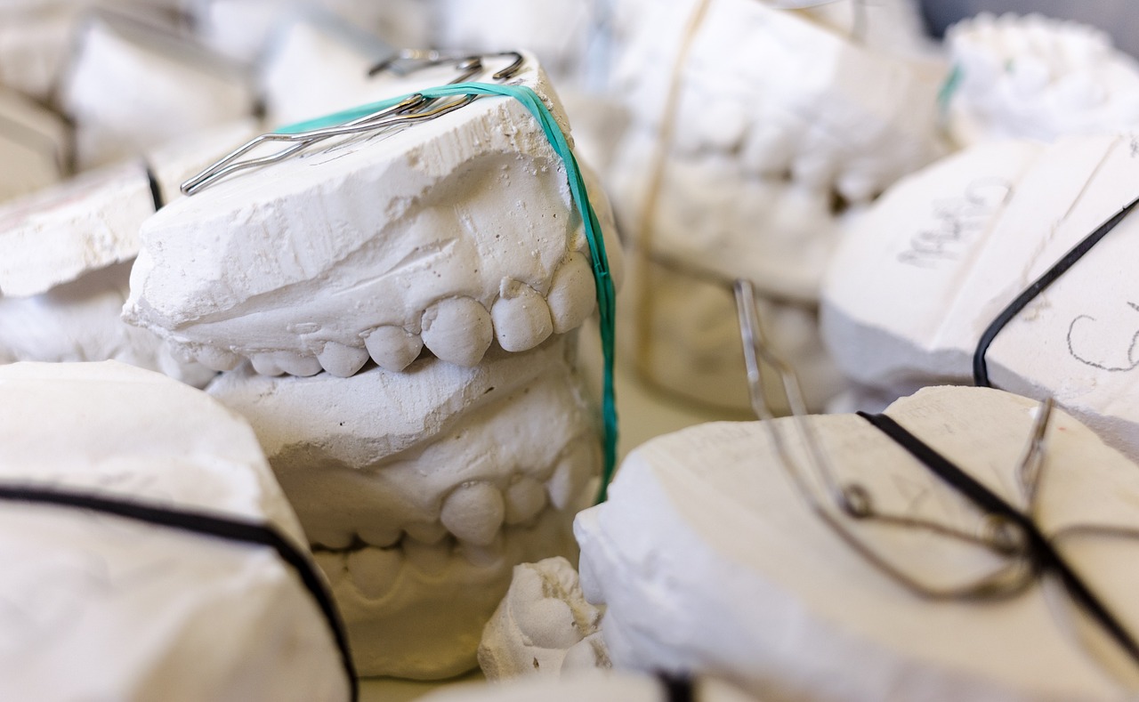 teeth, models, gypsum-797308.jpg